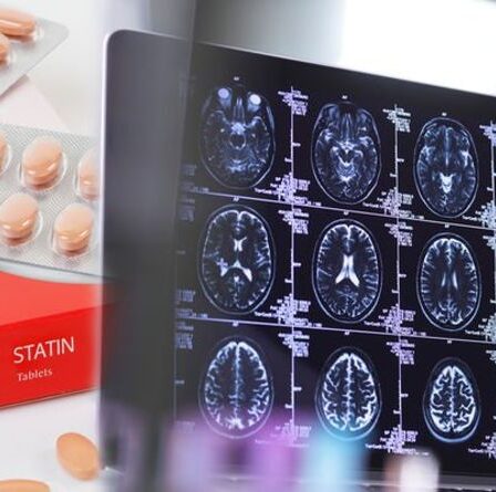 Effets secondaires des statines: la prise du médicament peut-elle augmenter votre risque de démence?  L'expert pèse