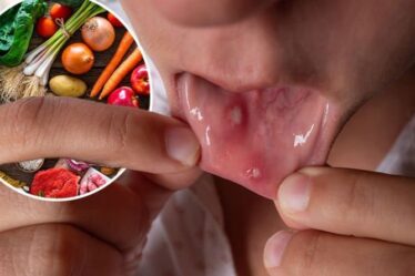 Symptômes de carence en vitamine B12: trois `` problèmes de bouche '' qui signalent de faibles niveaux de vitamine B12