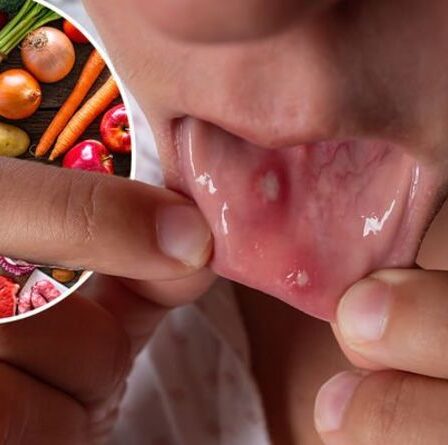 Symptômes de carence en vitamine B12: trois `` problèmes de bouche '' qui signalent de faibles niveaux de vitamine B12