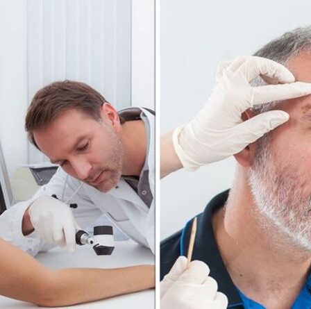 Symptômes du cancer: l'apparition d'un cancer de la peau à surveiller - carcinome basocellulaire
