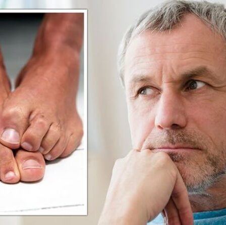 Symptômes du diabète de type 2: la pilosité de vos pieds peut indiquer une glycémie élevée