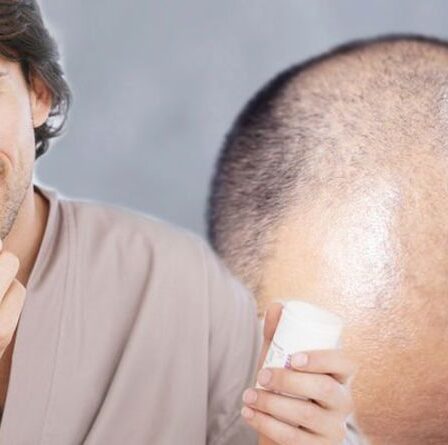 Traitement de la perte de cheveux: un comprimé oral pour bloquer une enzyme de la DHT augmentant la repousse des cheveux