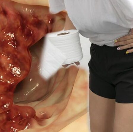 Cancer de l'intestin : la sensation inhabituelle liée à la selle qui peut être un signe avant-coureur