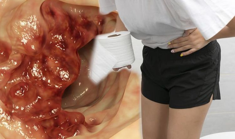 Cancer de l'intestin : la sensation inhabituelle liée à la selle qui peut être un signe avant-coureur