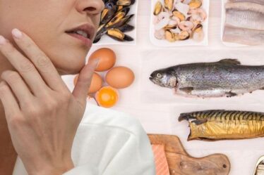 Carence en vitamine B12 : les nombreux signes faciaux indiquant que vos niveaux sont dangereusement bas