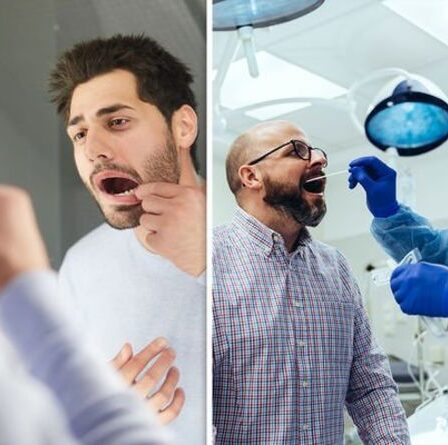 Carence en vitamine B12 : les signes dans votre bouche qui pourraient signifier que vous manquez de vitamine B12