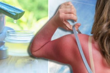 Comment apaiser les coups de soleil - 5 conseils pour rafraîchir la peau brûlée