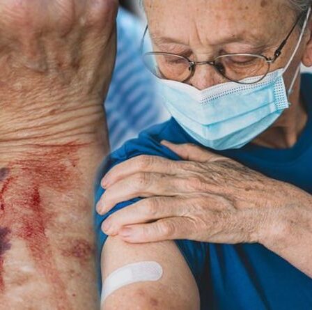 Effets secondaires du vaccin AstraZeneca : la thrombopénie idiopathique peut provoquer une hémorragie interne