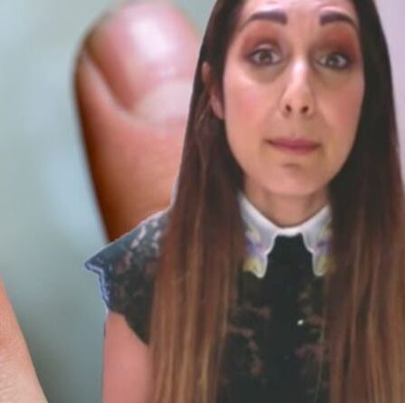 Le signe avant-coureur caché du cancer de la peau sous vos ongles exposés - Le Dr Sarra donne des conseils