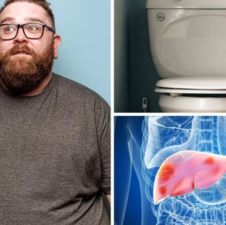 Symptômes de la stéatose hépatique : la texture de votre caca peut indiquer si votre organe est endommagé