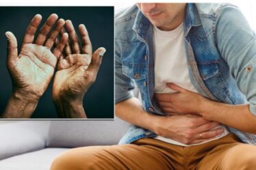 Symptômes de la stéatose hépatique : quatre signes sur la main peuvent indiquer que votre organe est endommagé