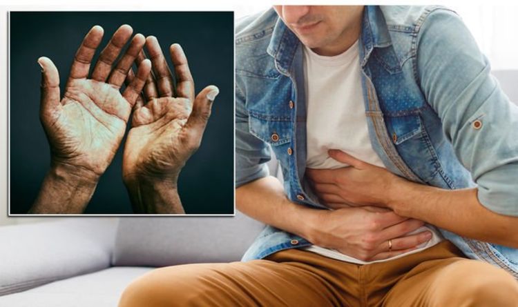 Symptômes de la stéatose hépatique : quatre signes sur la main peuvent indiquer que votre organe est endommagé