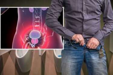 Symptômes du cancer de la prostate : la force de votre pipi pourrait être un signe avant-coureur