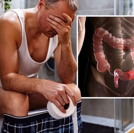 Symptômes du cancer de l'intestin : le caca de « crayon » pourrait être un signe avant-coureur