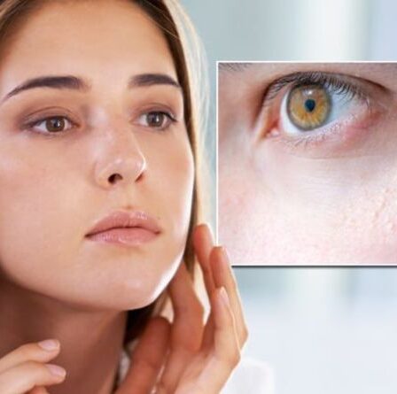 Taches blanches sur la peau : qu'est-ce que c'est ? Risque d'inflammation si elle n'est pas traitée