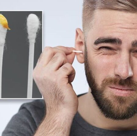 Cérumen : La couleur peut-elle indiquer un problème de santé ?  Quand consulter un médecin