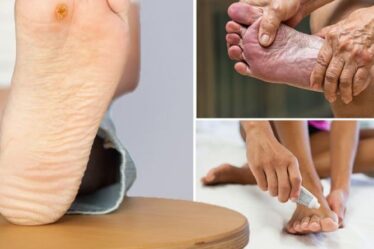 Diabète de type 2 : quatre problèmes de pied « graves » qui signalent des dommages de la glycémie aux nerfs