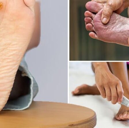 Diabète de type 2 : quatre problèmes de pied « graves » qui signalent des dommages de la glycémie aux nerfs