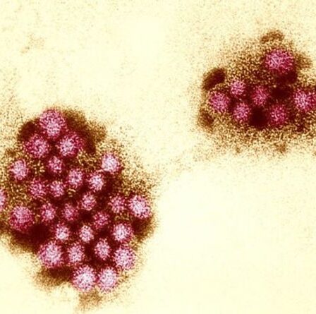 Épidémie de norovirus : les deux endroits où les infections à norovirus sont les PLUS ÉLEVÉES