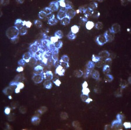 L'Allemagne met en garde contre un virus «plus dangereux que Covid» – l'alarme est déclenchée alors que les infections explosent