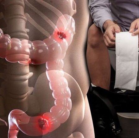 Santé intestinale : qu'est-ce qu'une couleur normale et qu'est-ce qui signifie une anomalie ?
