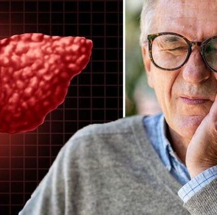 Symptômes de la stéatose hépatique : trois signes avant-coureurs graves dans votre bouche - que rechercher