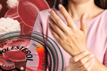 Symptômes d'hypercholestérolémie : le signe subtil dans vos doigts indiquant des niveaux élevés