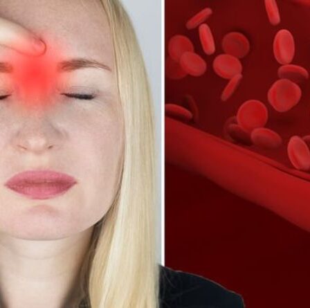 Symptômes d'hypercholestérolémie : les « croissances mineures » sur votre visage qui indiquent des niveaux élevés