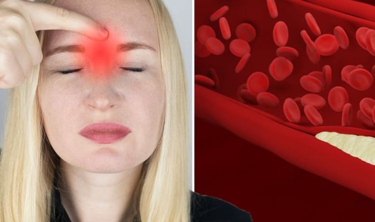 Symptômes d'hypercholestérolémie : les « croissances mineures » sur votre visage qui indiquent des niveaux élevés