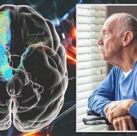 Fin de la maladie de Parkinson ?  Des scans 3D de pointe de cerveaux de singe offrent un espoir de lutter contre la maladie