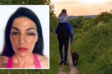 Horreur de Liverpool: un promeneur de chiens « a fouetté le propriétaire d'un carlin au visage » après l'éclatement d'une rangée dans un parc