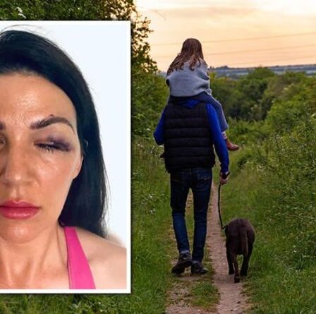 Horreur de Liverpool: un promeneur de chiens « a fouetté le propriétaire d'un carlin au visage » après l'éclatement d'une rangée dans un parc