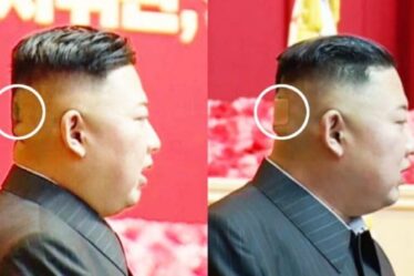 Kim Jong-un craint pour la santé : un point mystérieux et un pansement apparaissent à l'arrière de la tête du leader du NK