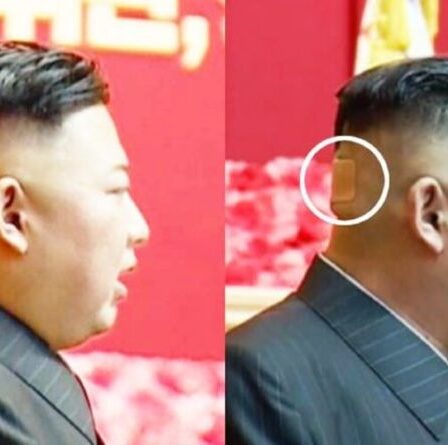 Kim Jong-un craint pour la santé : un point mystérieux et un pansement apparaissent à l'arrière de la tête du leader du NK