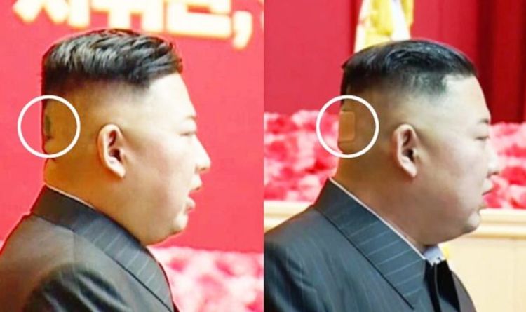 Kim Jong-un craint pour la santé : un point mystérieux et un pansement apparaissent à l'arrière de la tête du leader du NK