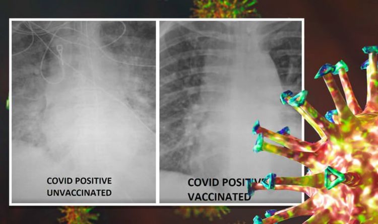 Les rayons X montrent une différence flagrante que font les vaccins Covid – avec des poumons non protégés ravagés par le virus