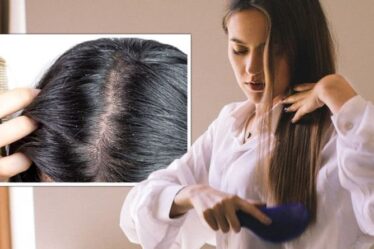 L'expert trichologue dit tout sur les pellicules : provoquent-elles la chute des cheveux ?