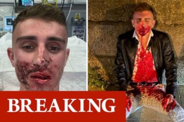 L'olympien Jack Woolley est resté couvert de sang lors de l'attaque quelques secondes après avoir posé pour la photo