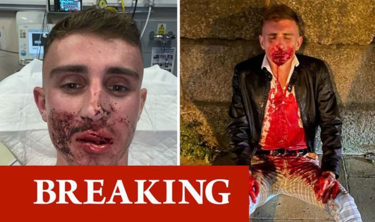 L'olympien Jack Woolley est resté couvert de sang lors de l'attaque quelques secondes après avoir posé pour la photo
