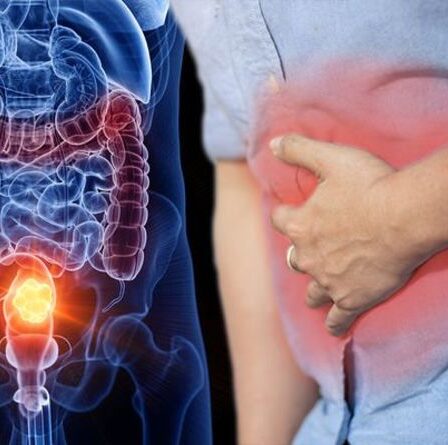 Percée contre le cancer : les scientifiques trouvent un moyen de détecter le cancer de l'intestin « aussi simple que le diabète »