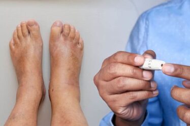 Signes de diabète dans vos pieds - les 14 symptômes à surveiller