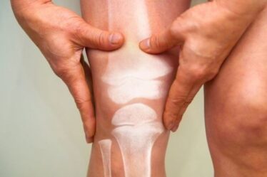 Symptômes de l'arthrite : cinq des signes d'arthrite les plus courants qui pourraient vous manquer