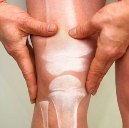 Symptômes de l'arthrite : cinq des signes d'arthrite les plus courants qui pourraient vous manquer