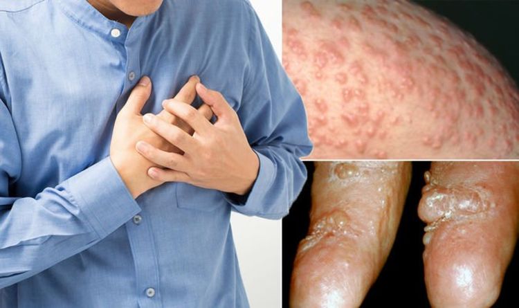 Symptômes des maladies cardiaques : pourquoi vous ne devriez jamais ignorer ces cinq signes subtils sur votre peau