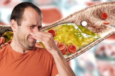Symptômes d'hypercholestérolémie : pouvez-vous sentir cela ?  Le signe d'avertissement malodorant d'un taux de cholestérol élevé