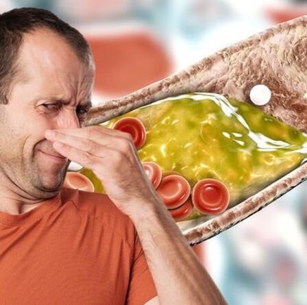 Symptômes d'hypercholestérolémie : pouvez-vous sentir cela ?  Le signe d'avertissement malodorant d'un taux de cholestérol élevé