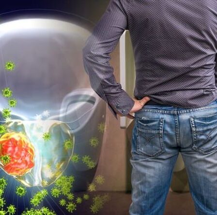 Symptômes du cancer de la prostate : signe clé avant de faire pipi, vous pourriez avoir la maladie