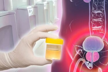 Symptômes du cancer de la prostate : signe d'avertissement dans votre flux d'urine - deux changements à ne jamais ignorer