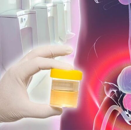 Symptômes du cancer de la prostate : signe d'avertissement dans votre flux d'urine - deux changements à ne jamais ignorer