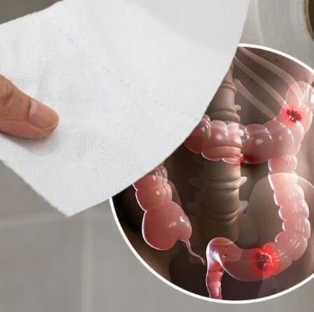Symptômes du cancer de l'intestin : deux indices visuels dans votre caca qui ne devraient « jamais être ignorés »